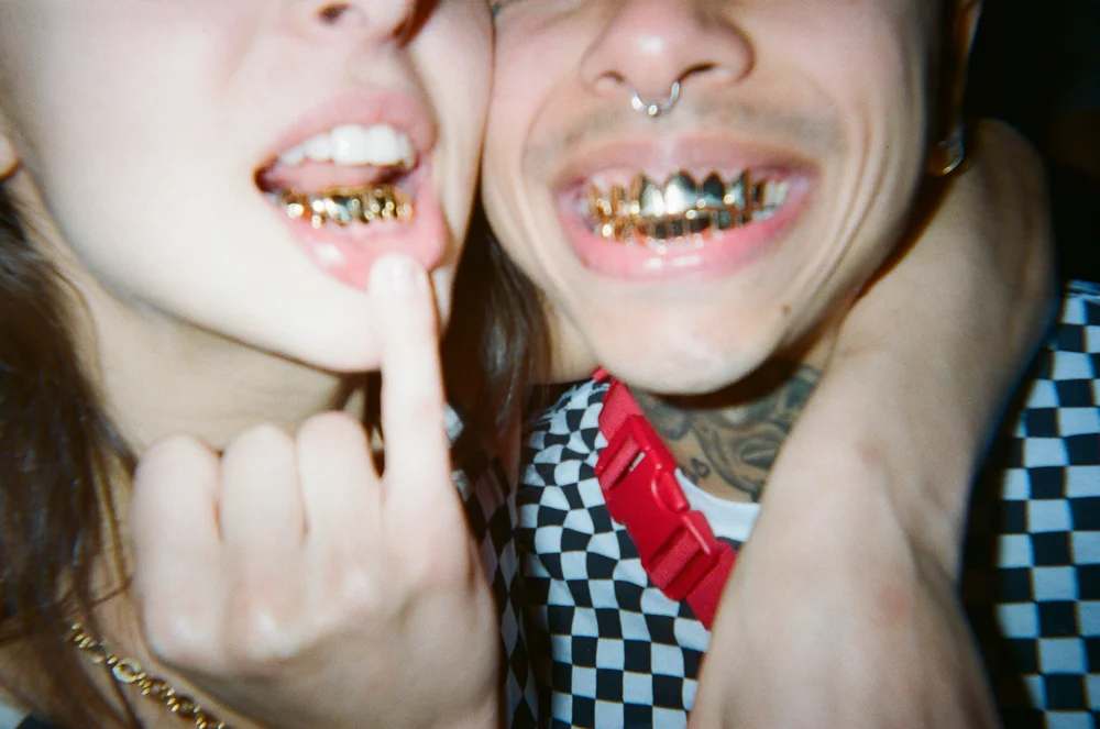 Two friends smiling with gold teeth
